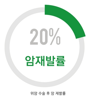 암 재발 환자 100명 중 8명, 수술 5년 넘어 ‘재발’