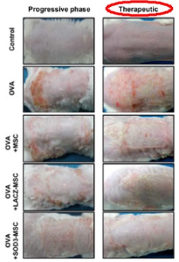 토피피부염이 유발된 동물(쥐)에 항산화효소 SOD3를 도입한 중간엽 줄기세포를 투여한 결과, 피부 두께 및 염증반응이 효과적으로 감소된 것을 확인하였다.