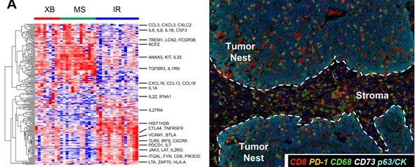 좌측부터 그림1) 유전자 분석을 통한 구인두암의 3가지 아형, 그림2) 고면역성 타입(immune-rich)의 환자의 다중면역염색 소견