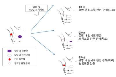 (그림 1) 림프절 전이 HER2 양성 유방암에서 선행 치료에 따른 유방 및 림프절 관해(치료) 결과 예시