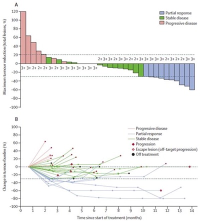 Trastuzumab과 FOLFOX치료를 받은 HER2-양성 담도암 환자별 종양 축소율(A)과 치료 진행에 따른 종양 크기 변화(B)