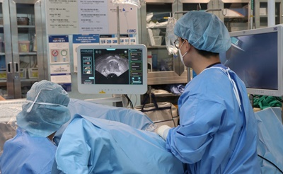 삼성서울병원 비뇨의학과 이규성 교수가 로봇수술 장비 ‘아쿠아블레이션’을 사용해 전립선비대증 수술을 하고 있다