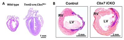 마우스모델의 심장(왼쪽)에서 Cbx7 유전자 활성을 조절해 심근세포를 억제했을 때 심장의 크기가 증가하고 심근의 두께가 증가했다(오른쪽). B: 심장마비 마우스모델(왼쪽)에서 Cbx7 유전자를 제거한 결과, 심장 섬유화가 감소하고 심근이 증가했다(오른쪽).