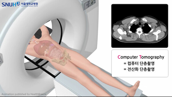 저선량 흉부CT 검사 모식도 (출처: 서울대병원 암정보교육센터)