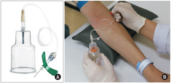  안전나비바늘, 루어 어댑터 및 혈액배양홀더를 이용하여 혈액배양병에 직접 혈액을 채취하고 있다.